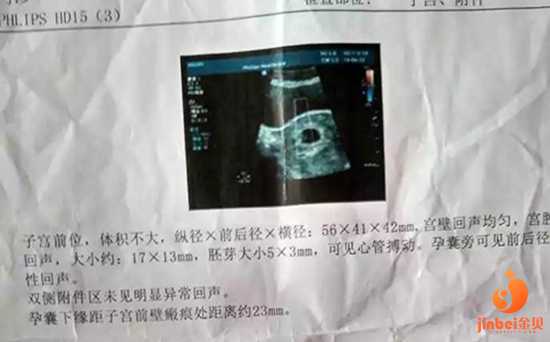徐汇个人代孕电话,外地人在深圳做试管婴儿有什么补贴吗-2022湖南益阳生育政策