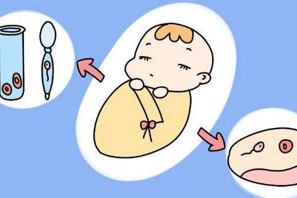 榆林私人供卵_泰国试管婴儿攻略索引：生男孩，技术选择性别