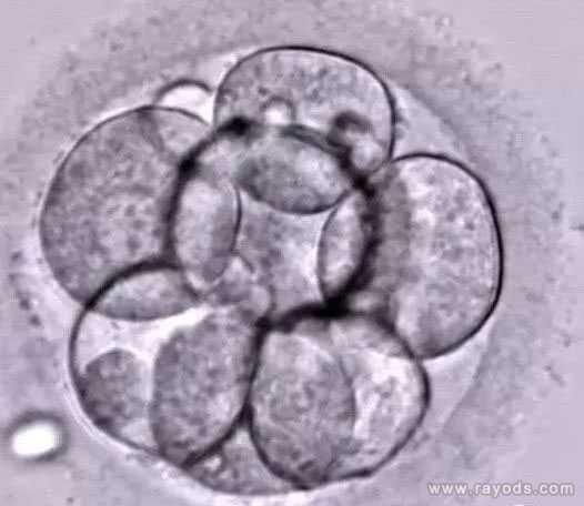威海供卵中心有哪些_威海供卵就选李广_试管胚胎等级怎么划分的 4aa是什么意思