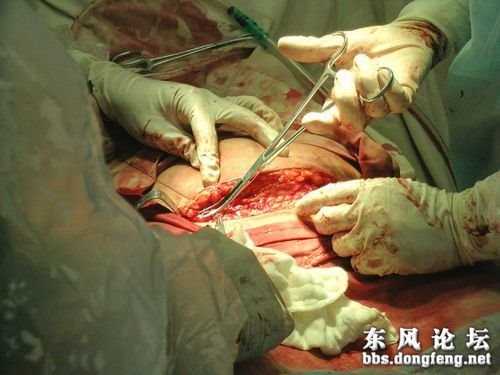 上海代生的条件_试管婴儿胚胎实验室大揭秘