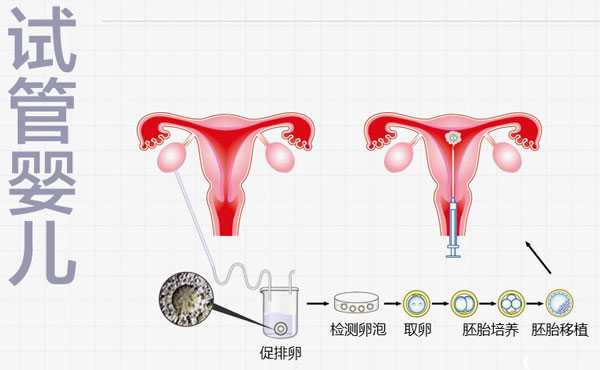 上海代孕成功_试管促排方案决定移植具体时间，降调针多久能移植