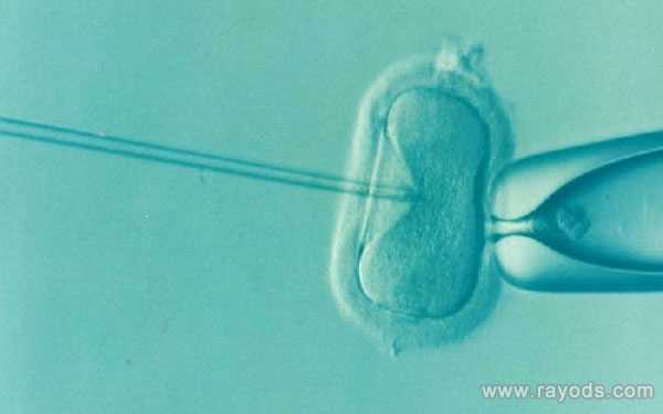 威海代孕生殖中心供卵_威海代孕找哪家医院_格鲁吉亚做试管婴儿安全吗？