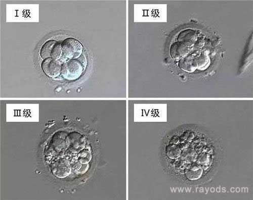 顺义代孕生女孩费用_试管婴儿的胚胎等级怎么区分