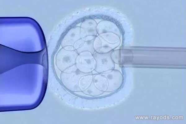 乌鲁木齐最新代孕价格_乌鲁木齐哪里能做代孕_宫腔镜检查对于日本试管婴儿胚