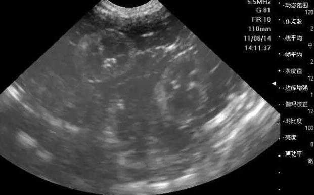 北京供卵受孕 北京双独生二胎有哪些奖励 ‘b超怀孕6个月如何看是女儿还是儿