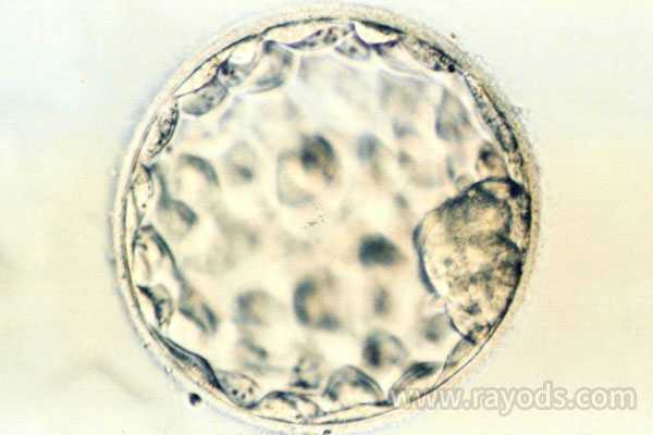 博尔塔拉代孕全部过程_囊胚培养，做试管婴儿我们是否需要养囊？