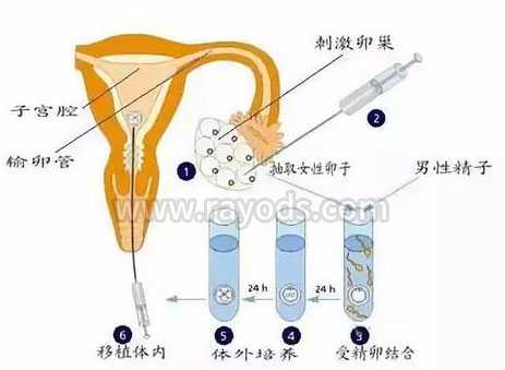 临沧目前代孕成功率_爆料！上海三代试管婴儿步骤复杂吗？